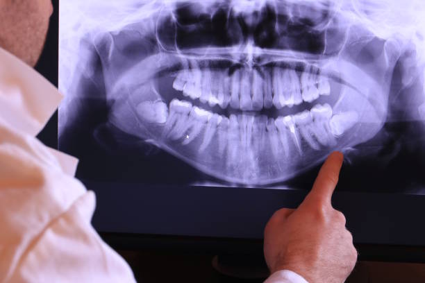 Best Emergency Denture Repair in Franklin, TN