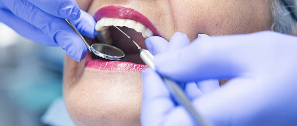 Best Emergency Dental Care for Broken or Chipped Teeth in Franklin, TN