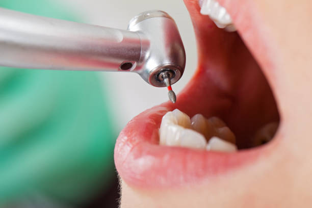 Best Emergency Treatment for Dental Infections or Abscesses in Franklin, TN